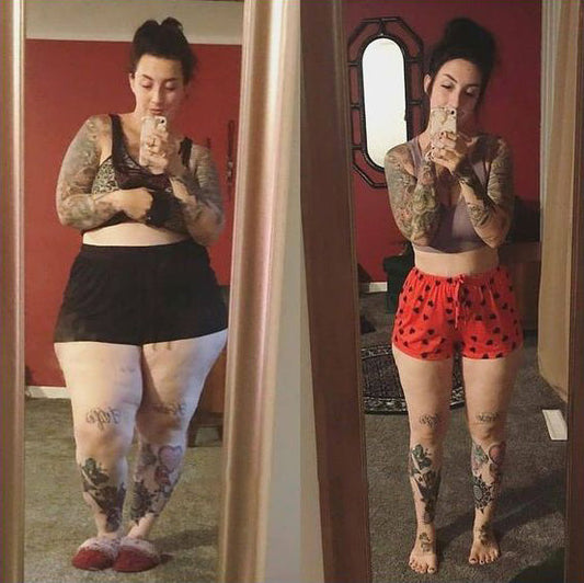 "The lymphedema has finally healed." - Amanda Y., 39